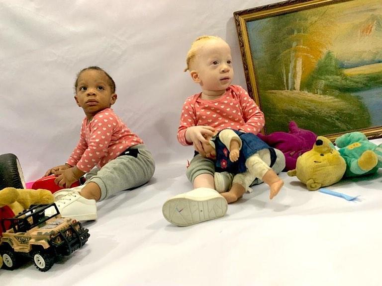 Casal nigeriano tem filhos gêmeos, um deles branco, e causam supresa nas redes sociais - Papo de Pai